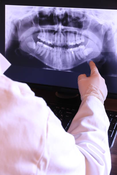 Best Emergency Broken Tooth Repair in Liberty Hill, TX