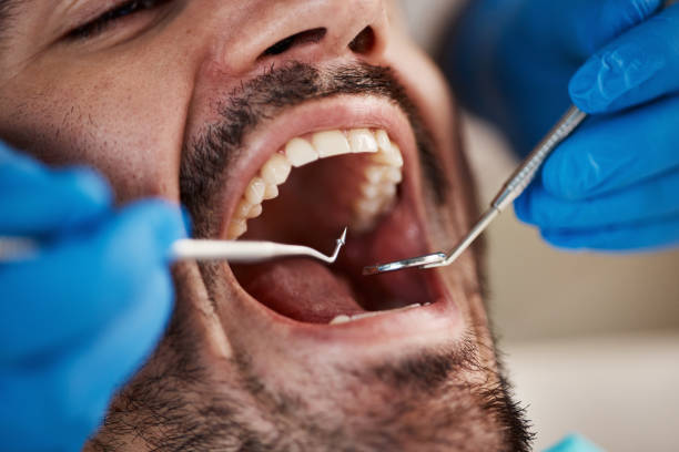 Best Emergency Root Canal Treatment in Liberty Hill, TX